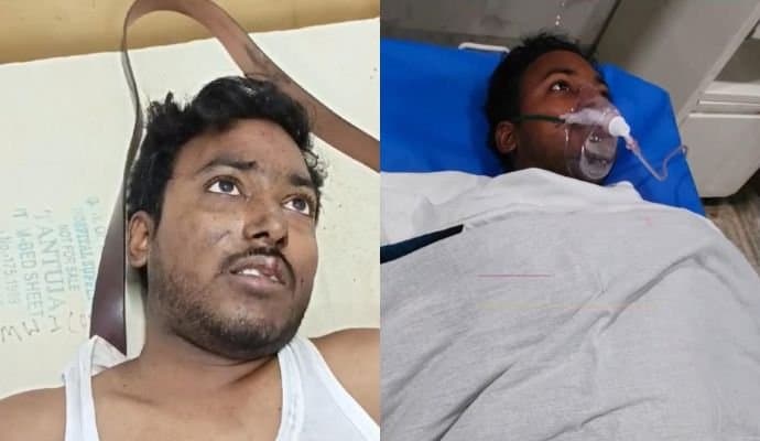 Kanchenjunga Express Accident: দুর্ঘটনাগ্রস্ত মালগাড়ির সহকারি চালক এখনও জীবিত 