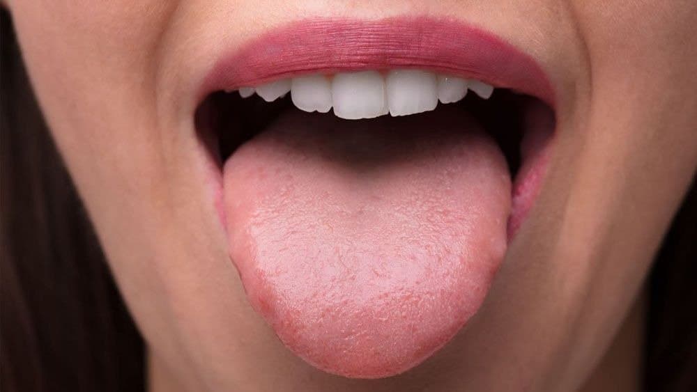 colour change of tongue can indicate various diseases here is all details lif 