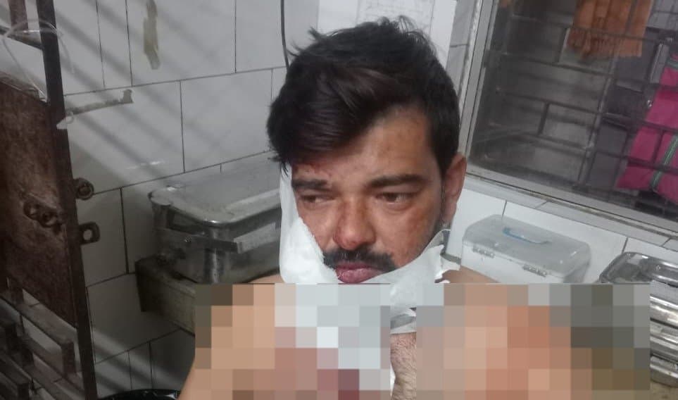 Murshidabad: বহরমপুর থানার অস্থায়ী গাড়ি চালকের উপর হামলা, গ্রেপ্তার ১ 