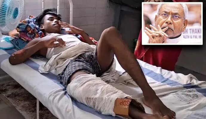 NITISH OR NITISH: বিহারে নীতীশ কুমারের ভাঙা পা জোড়া দিতে ব্যবহার করা হল কার্ডবোর্ড !
