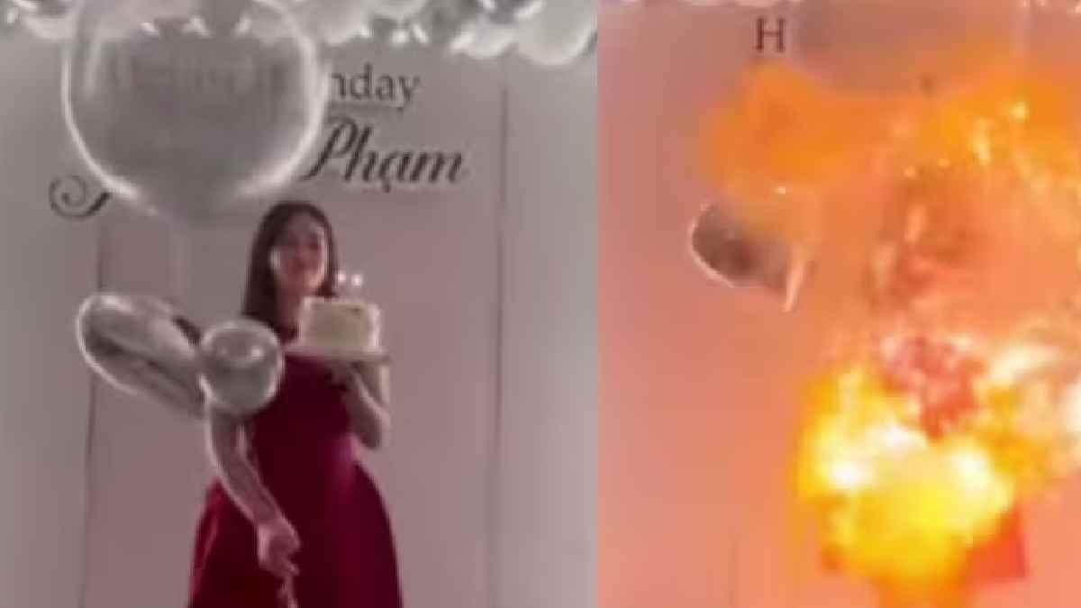  Vietnamese woman's face burned on her birthday