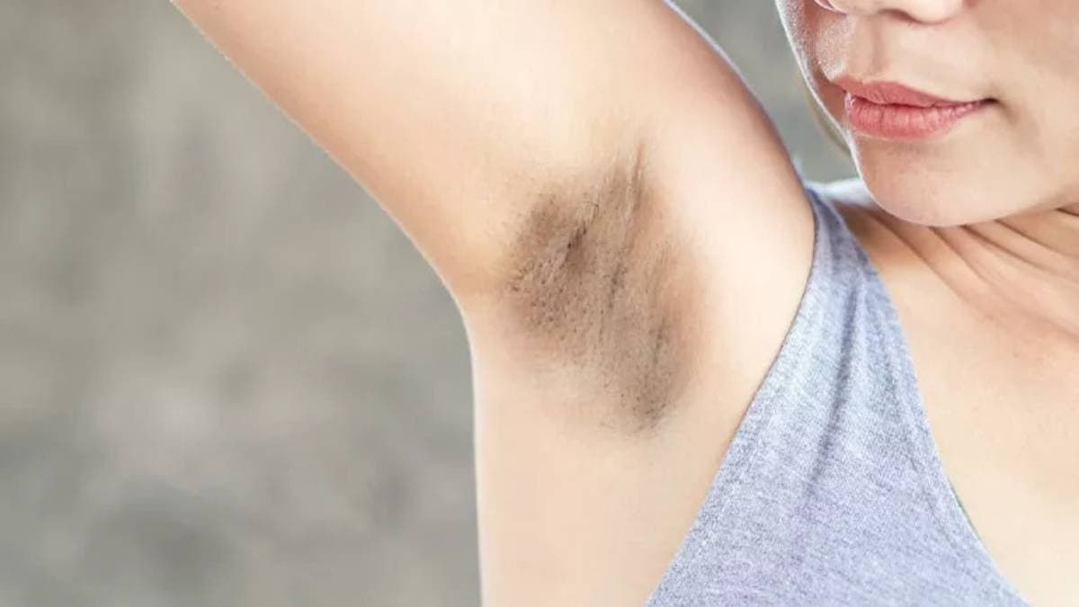 These easy Home remedies help to get rid of Dark Underarms