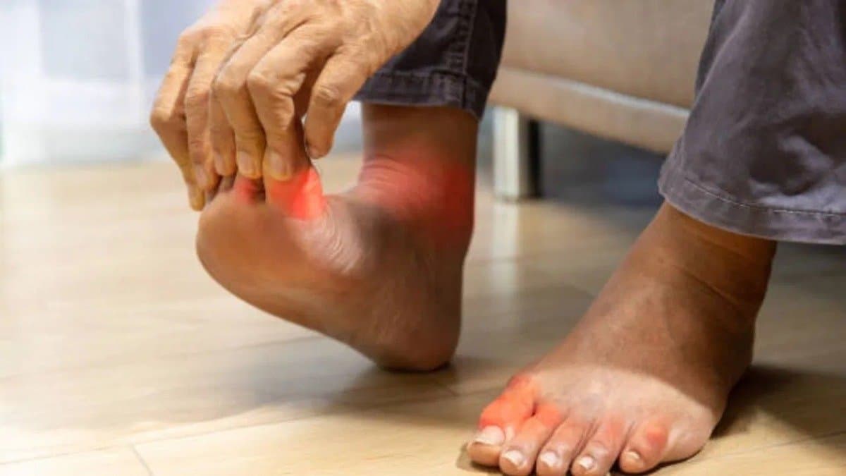 These food items can increase uric acid know what are their replacements