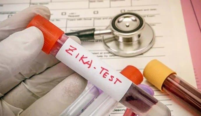  66 Cases Of Zika Virus Infection Found In Pune City Since June