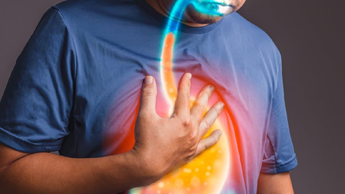 Three Home remedy for acid reflux