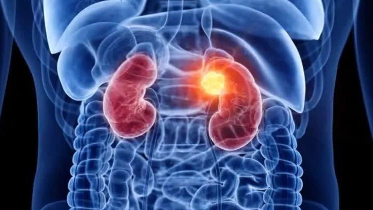 These five signs Of Kidney damage appear at night should never be ignored