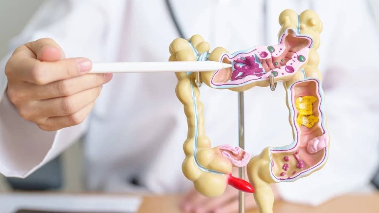 A new poop test can detect colon cancer with 90 percent accuracy 