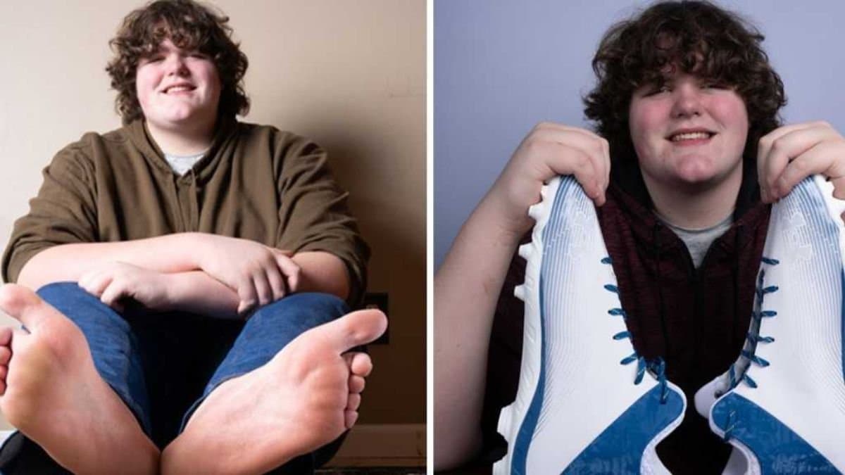 Teenager enters Guinness World Records for largest feet and hands_gnr