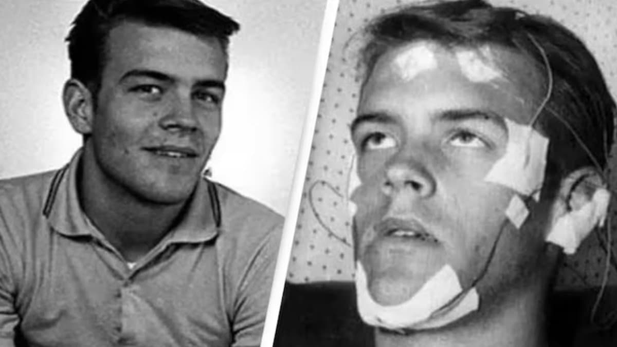 Man who did not sleep for 11 straight days made shocking revelation