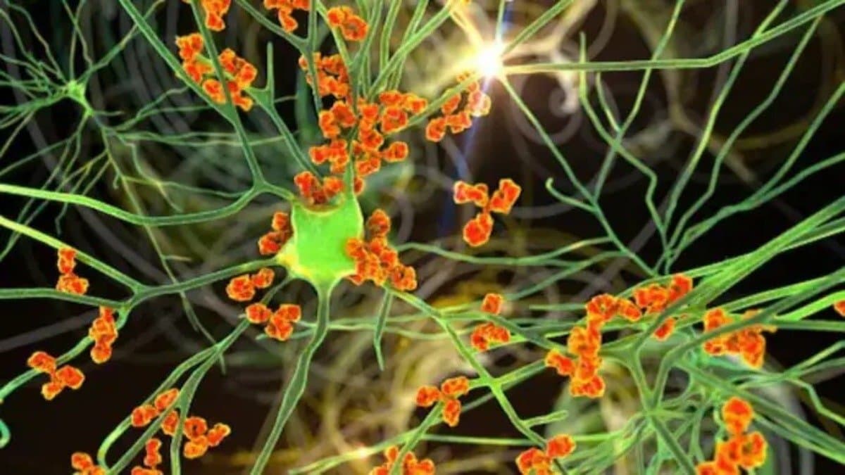 What Causes Guillain Barre Syndrome how dangerous this disease Renowned Neuro Doctor Saptarshi Basu explains its symptoms and all details lif