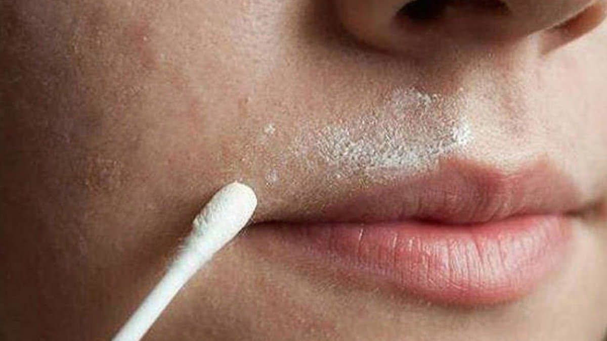 These home remedy help to remove unwanted facial hair know easy methods