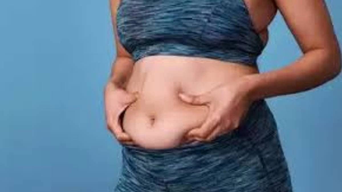 Coriander seeds can reduce belly fat