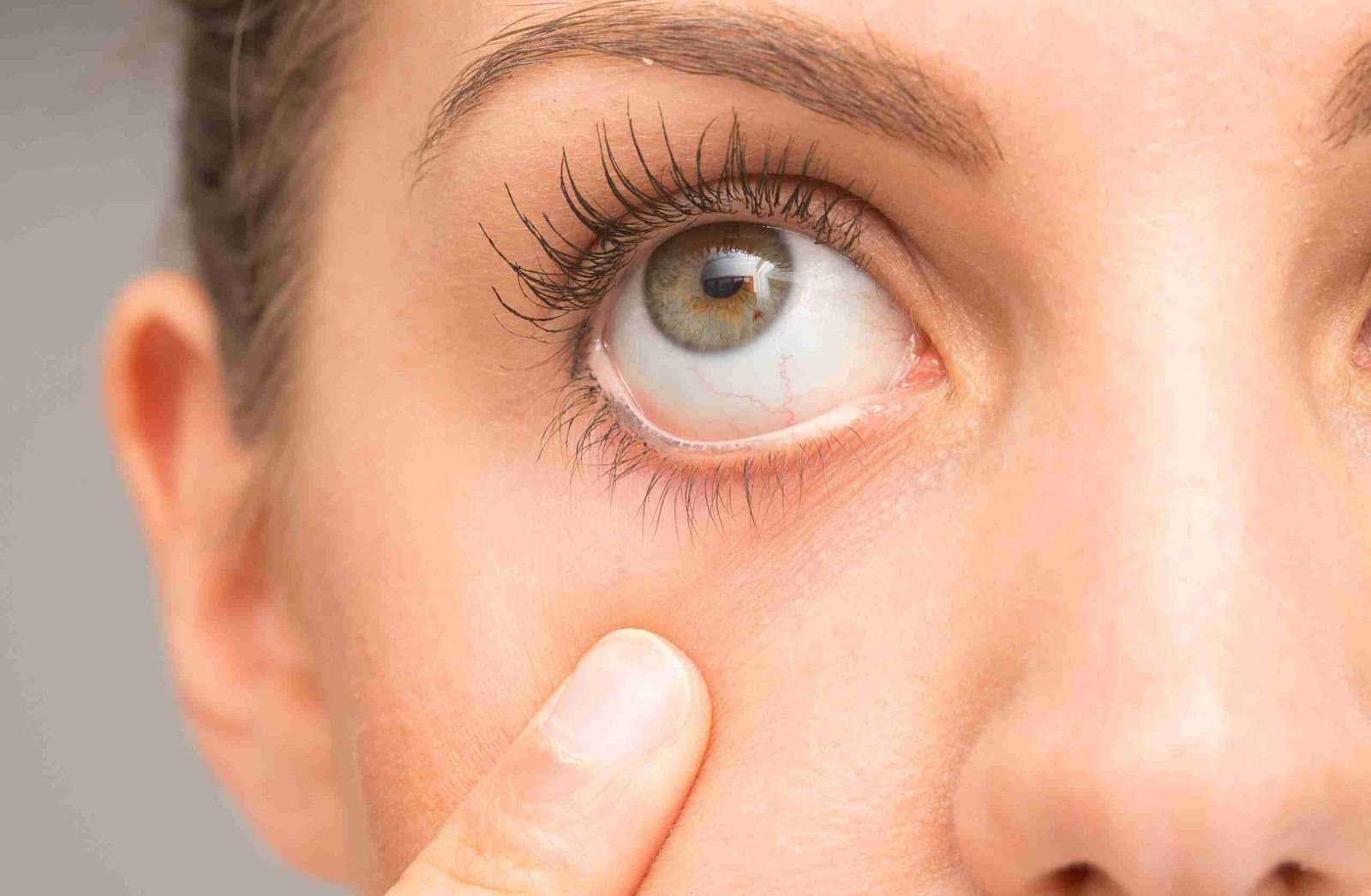 Eye Health: এলার্জি, ড্ৰাই আইস, ইনফেকশন! গরমে চোখের সমস্যা এড়াতে কী কী সাবধানতা মেনে চলবেন?
