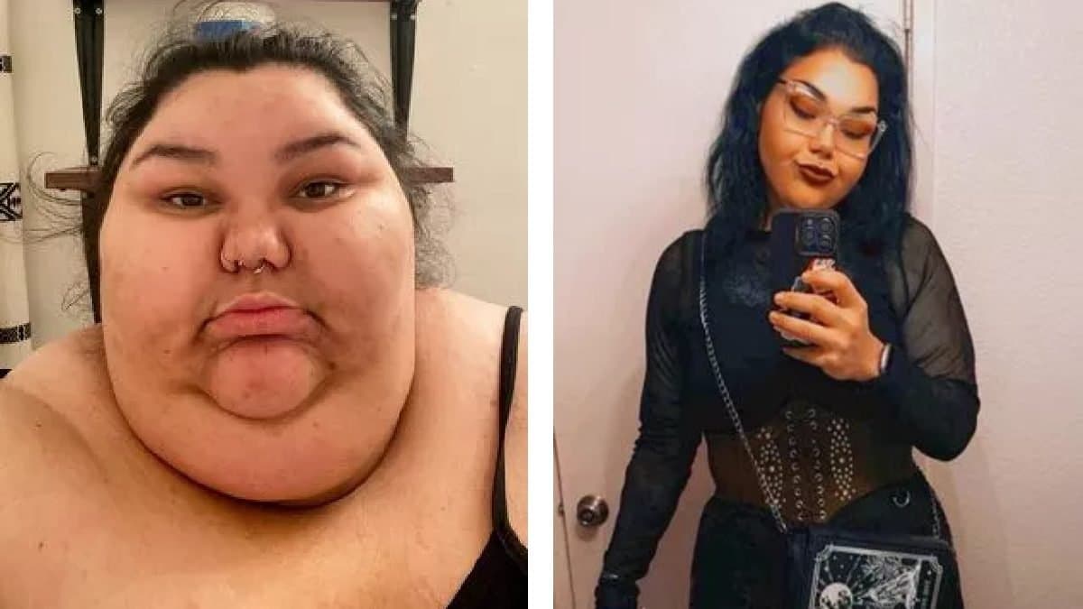 Incredible weight loss journey: woman lost 190 kilograms of weight in three years