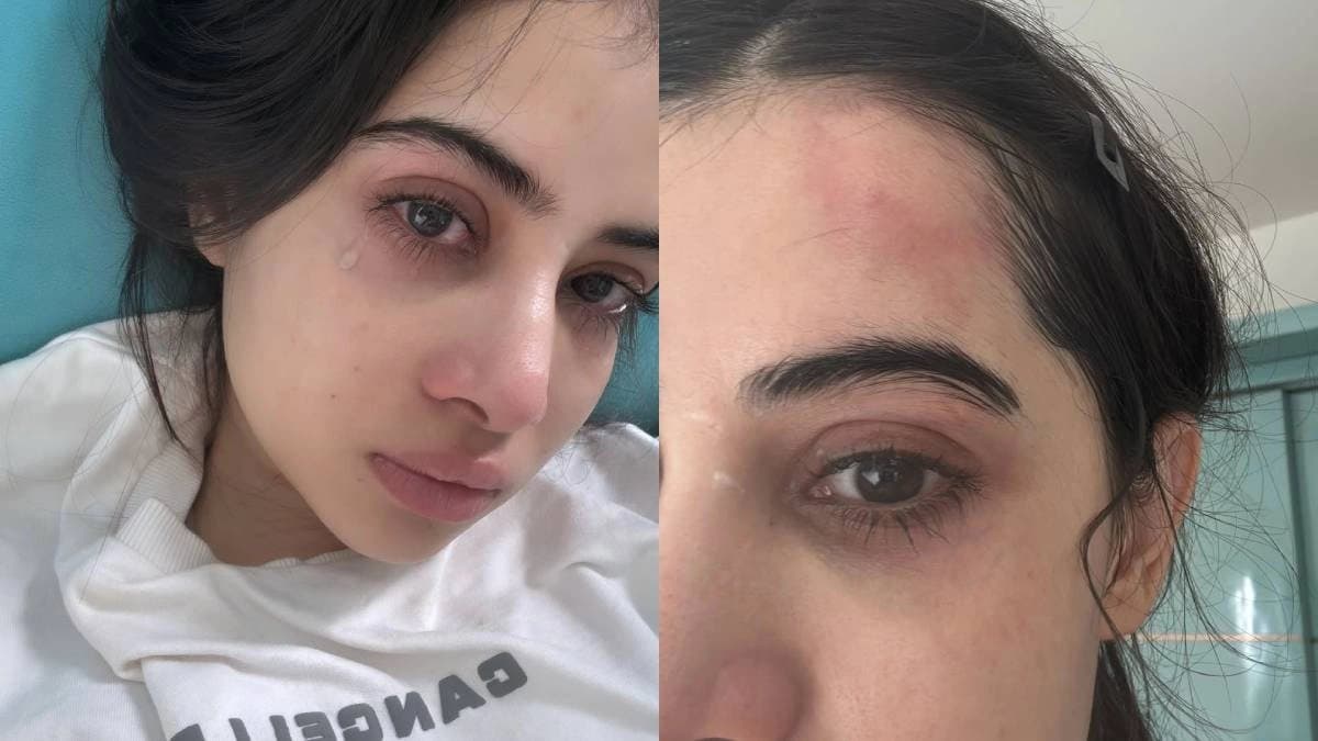 Urfi Javed Sparks Concern After Posting Crying Selfie