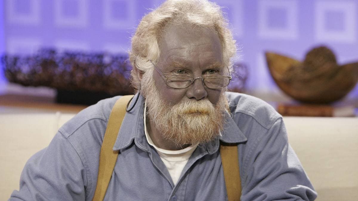 Bizarre Health Condition: Argyria is a rare disease that turns people into blue