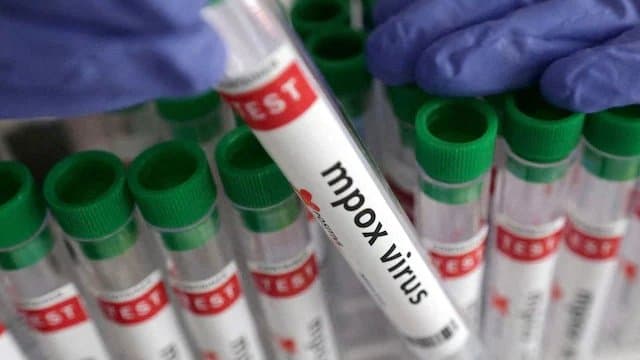 Kerala Confirms Second Mpox Case gnr