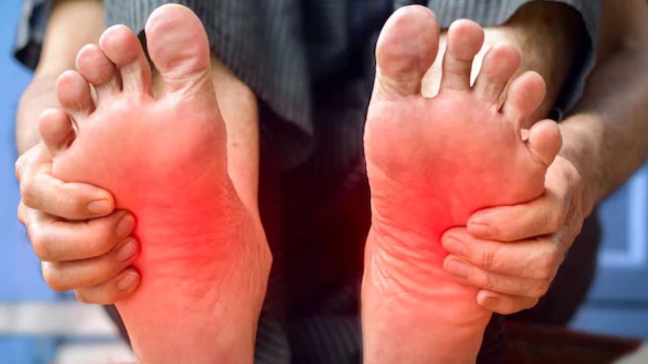 Vitamin B12 Deficiency The First Alarming Symptoms Often Show Up in Your Legs