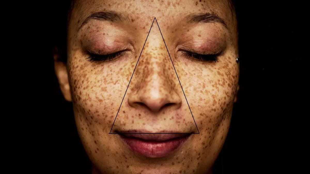 মুখের ‘মারণ ত্রিভুজ’-এর ব্রণ হয়ে উঠতে পারে মৃত্যুর কারণ! ভুলেও ফাটাতে যাবেন না, সর্বনাশ হয়ে যাবে