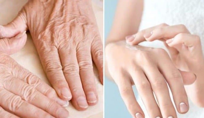  This home made pack can prevent dryness of your hand and make hands beautiful..