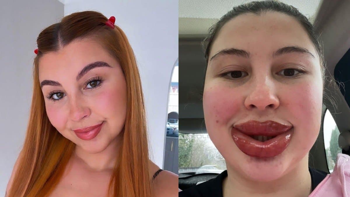lip tattoo left british woman look like a Monsters Inc villain lif