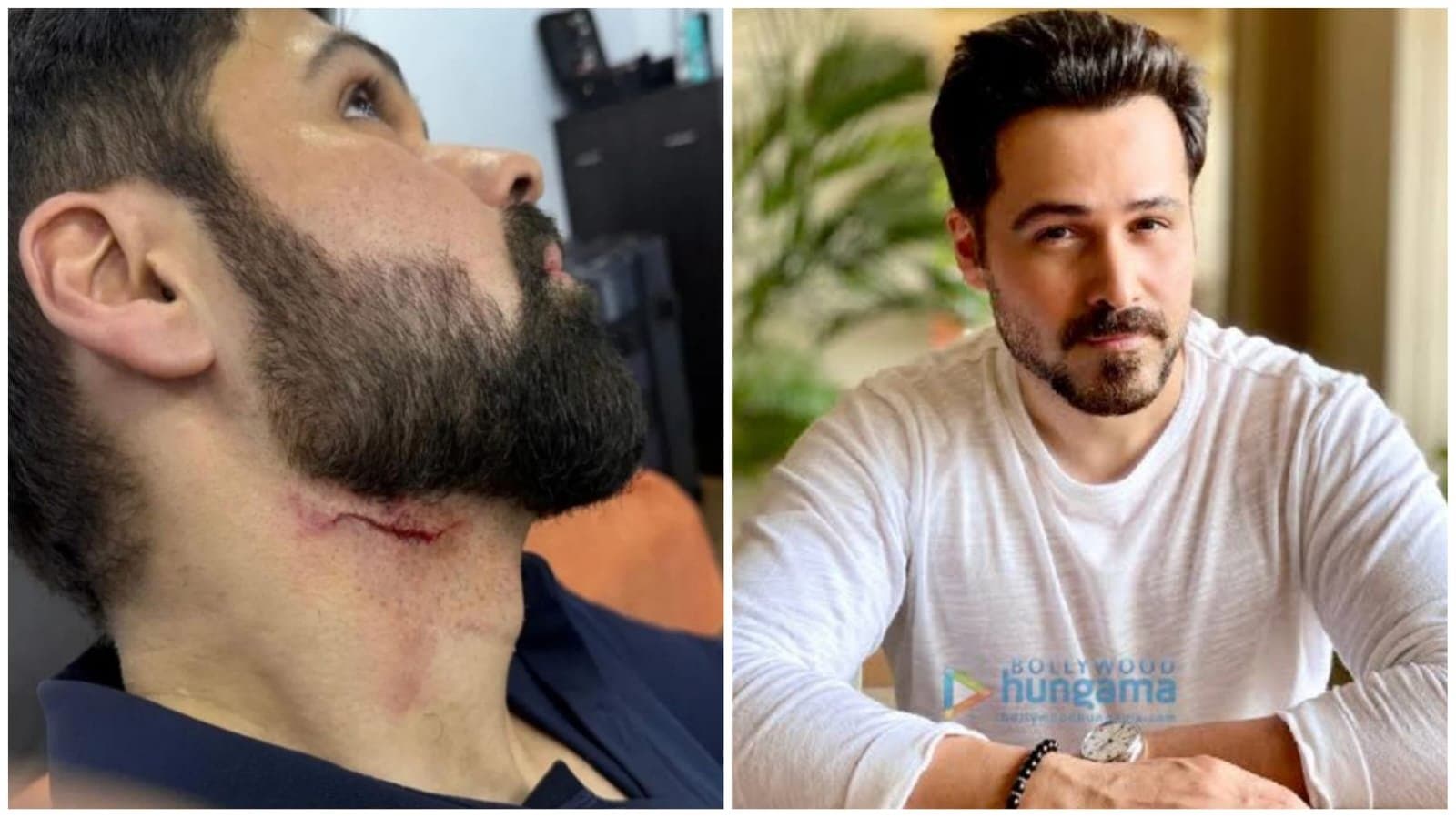 emraan hashmi injures himself during shoot of hoodachari 2 in hyderabad ent