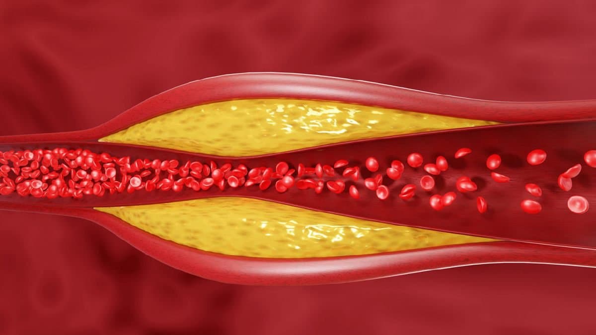 Green Tea Amla drink among top Home remedies to reduce Cholestrol