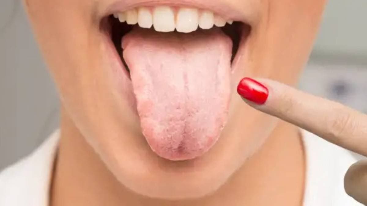 These changes in tongue can indicate the presence of dangerous diseases