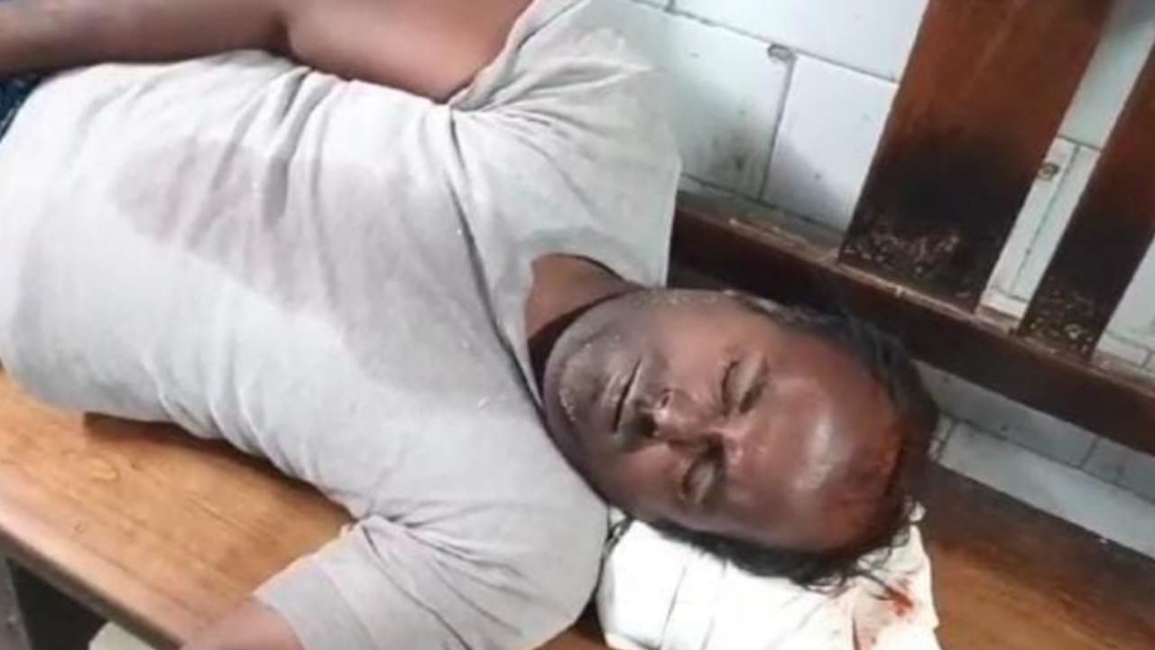 Hooghly: পান্ডুয়ায় প্রকাশ্যে কৃষকের চোখে লঙ্কার গুঁড়ো ছিটিয়ে নগদ টাকা ছিনতাই 