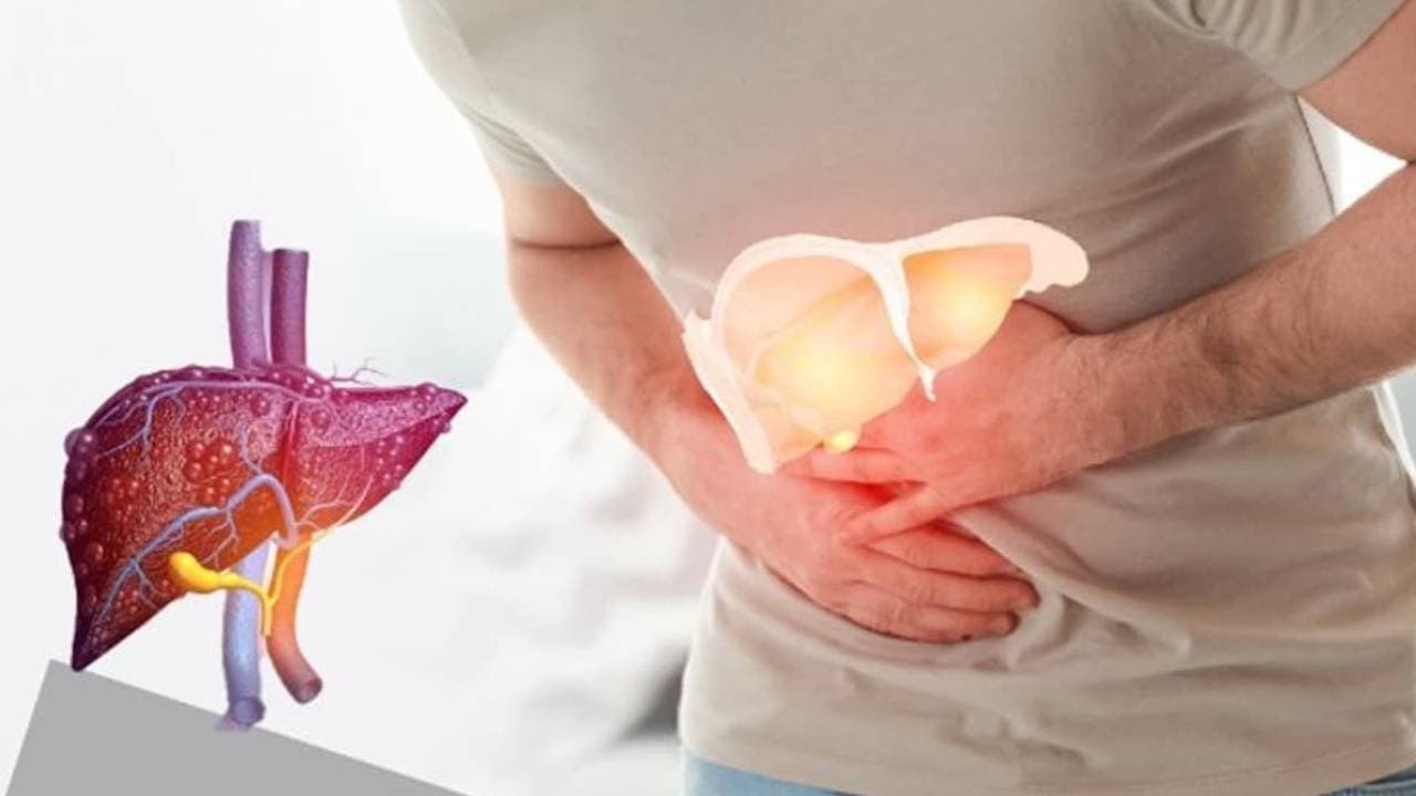 Health Tips: These foods help to cure Fatty Liver Disease