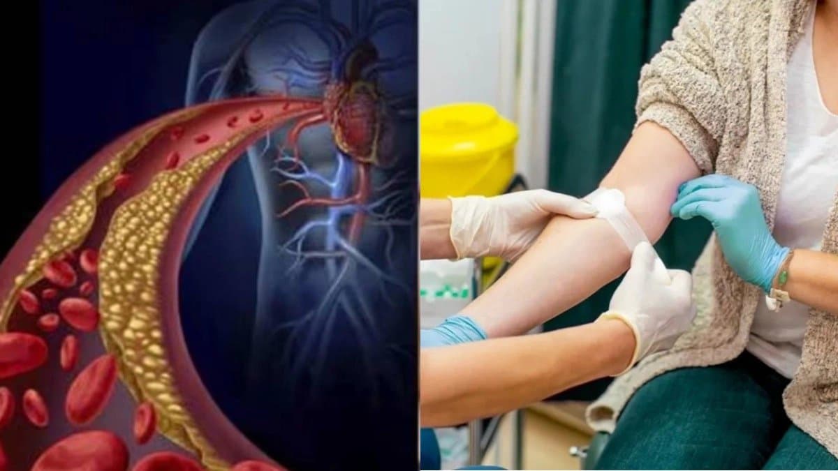 At what age should you first get your cholesterol checked