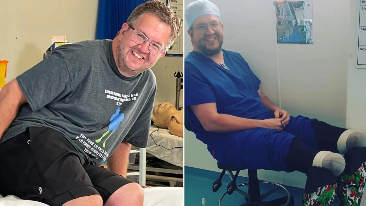 British Surgeon amputated his feet for five crore rupees insurance an adult site revealed the truth