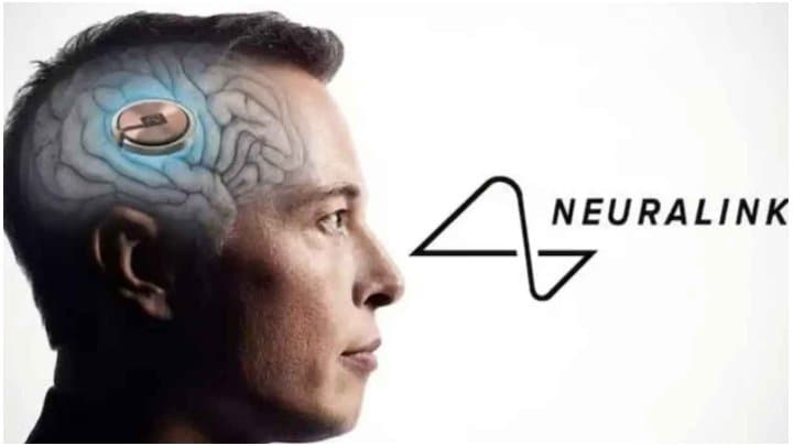 chip transplant successful in human brain
