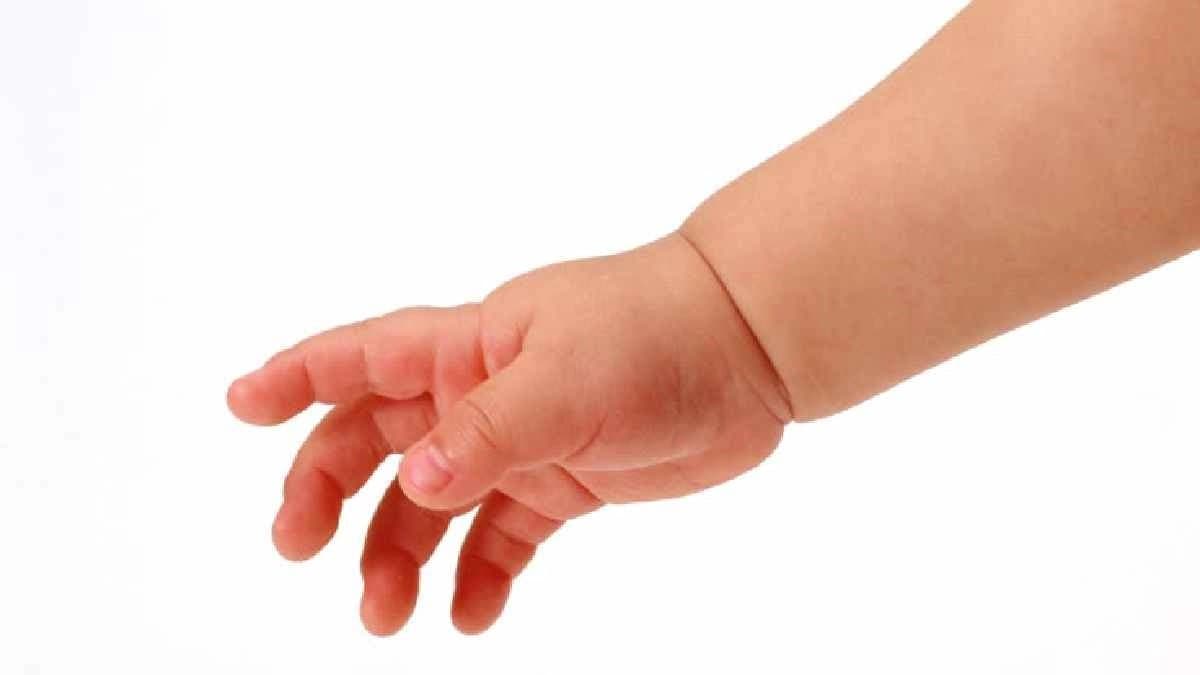 A three-month-old child was found without his genital parts