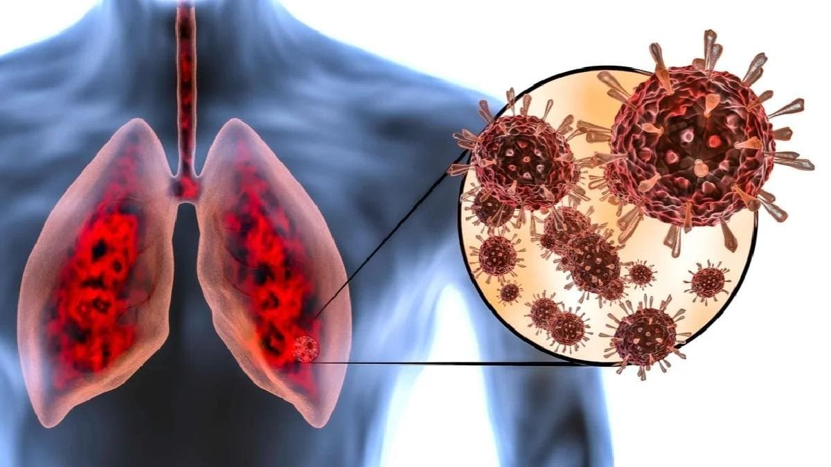 Primary symptoms of new human corona virus include cough and cold