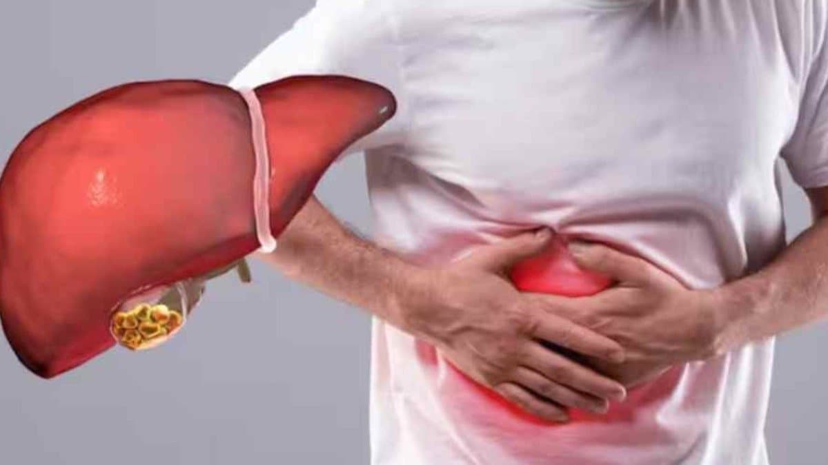 This drinks are very effective to reduce fatty liver within two weeks 