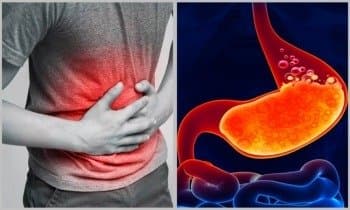  10 Best Foods To Relieve Gas And Bloating Naturally LIf