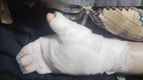 Mumbai Teacher Burns Eight Year Old Boy Hand With Candle Over Bad Handwriting