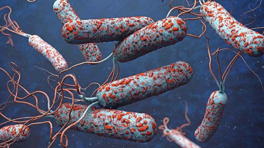 Cholera kills 58 sickens 1300 in sudan over three days gnr