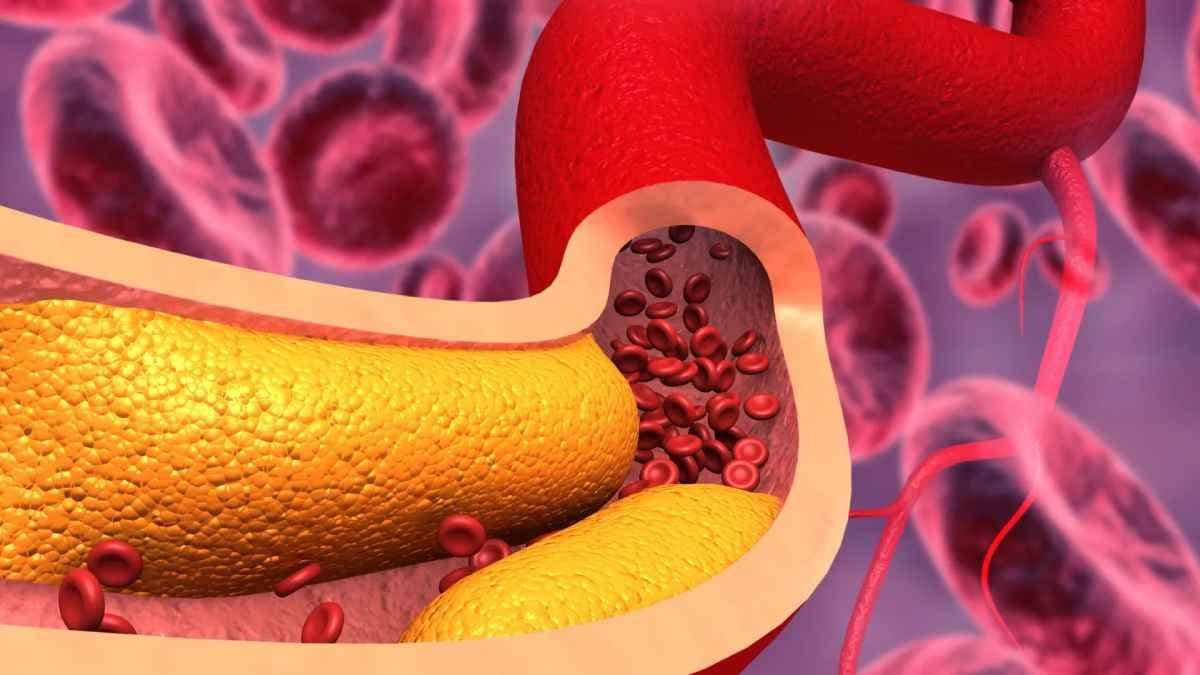 Five raw foods which help to prevent Heart Attack and lowers Cholesterol