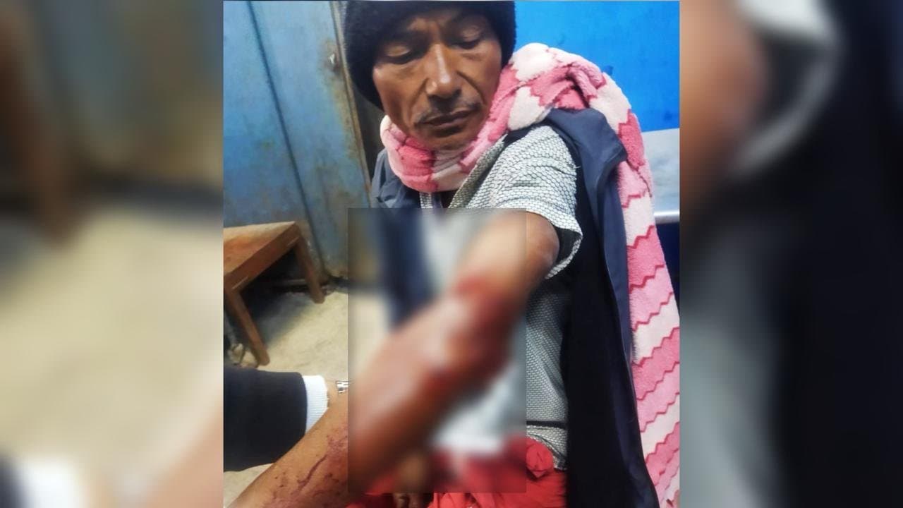 ATTACK: ফালাকাটায় চিতার হানায় জখম এক ব্যক্তি