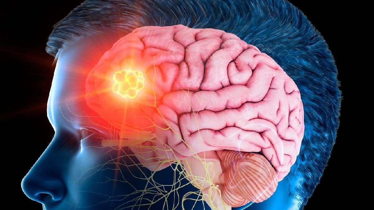Brain Tumor symptoms
