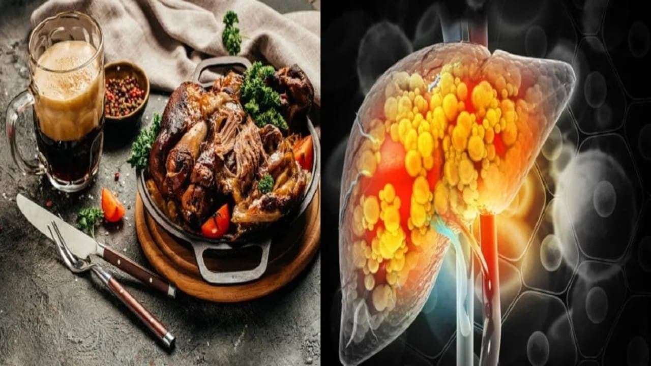  Not only alcohol these 5 foods can damage liver and fatty liver may occur lif