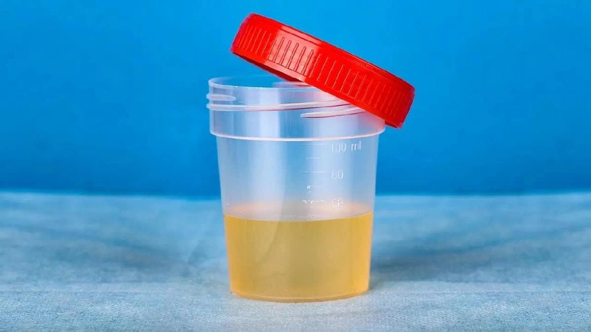 Male Giraffes taste female urine to determine if she is ready to make Physical Intimacy