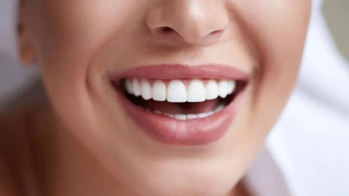 know this effective home remedy to get rid of yellow spot and tartar on teeth lif