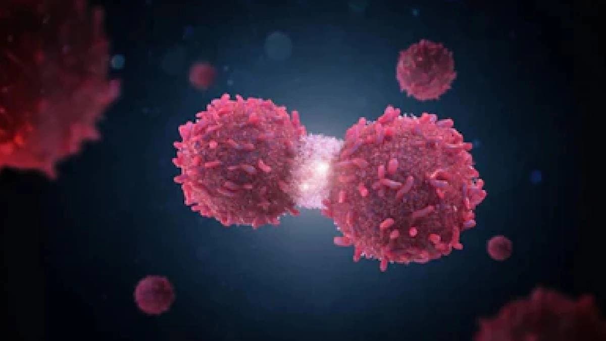 Oncologist warns even non drinkers are at risk as liver cancer rises among youth