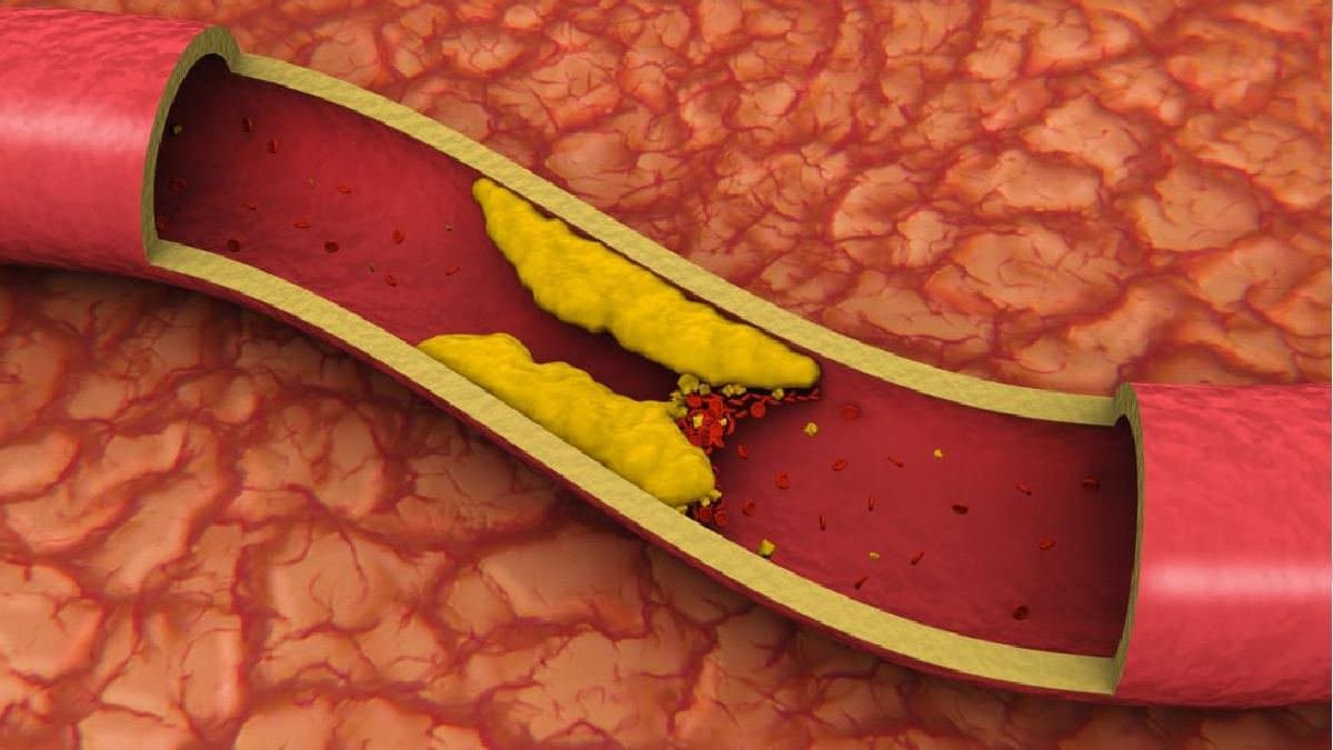 This is how cycling helps to reduce the chance Heart Attack and Diabetes