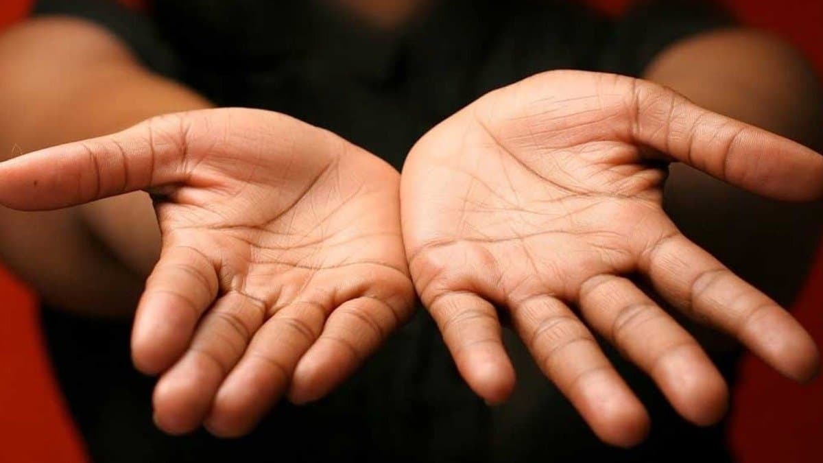 Health Tips: Temperature of your hands can reveal gut health