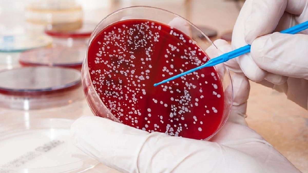 দাঁত থেকে ক্রমাগত রক্ত পড়ে? ব্লাড ক্যানসার নয় তো? কীভাবে চিনবেন এই মারণরোগ?