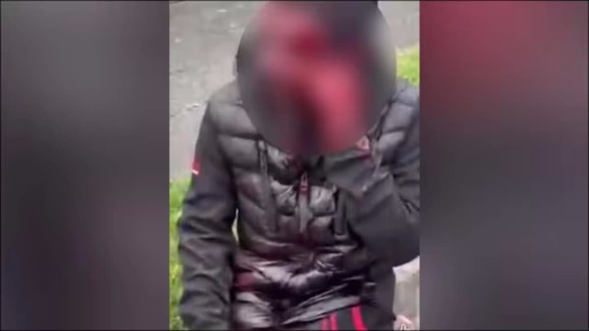 Indian man brutally beaten and stripped in Ireland